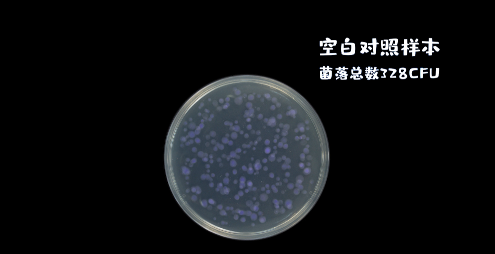 年纪轻轻的90后,竟然英年早秃了!实验告诉你,头发是怎么秃的! 年纪轻轻的90后,竟然英年早秃了!实验告诉你,头发是怎么秃的!