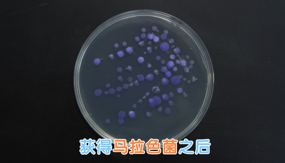 年纪轻轻的90后,竟然英年早秃了!实验告诉你,头发是怎么秃的! 年纪轻轻的90后,竟然英年早秃了!实验告诉你,头发是怎么秃的!