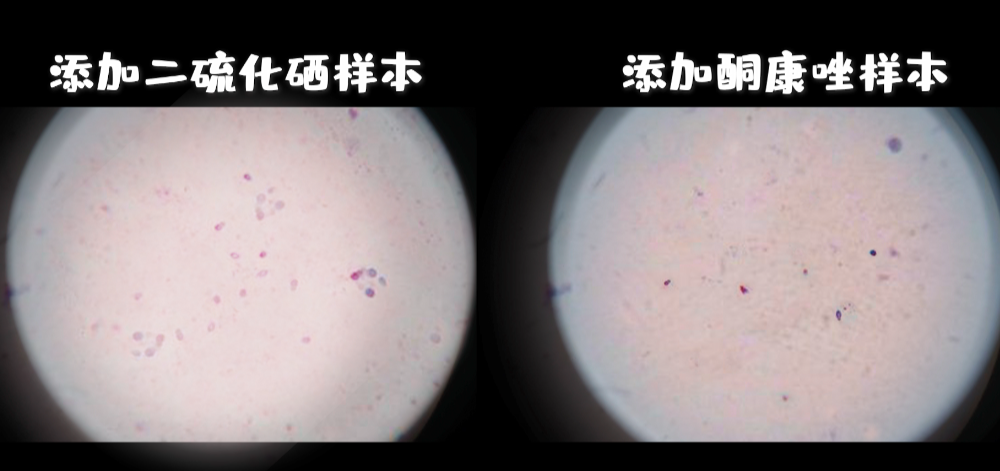年纪轻轻的90后,竟然英年早秃了!实验告诉你,头发是怎么秃的! 年纪轻轻的90后,竟然英年早秃了!实验告诉你,头发是怎么秃的!