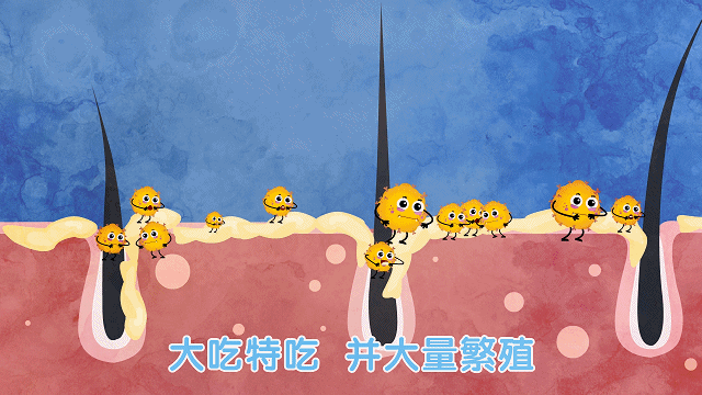 年纪轻轻的90后,竟然英年早秃了!实验告诉你,头发是怎么秃的! 年纪轻轻的90后,竟然英年早秃了!实验告诉你,头发是怎么秃的!